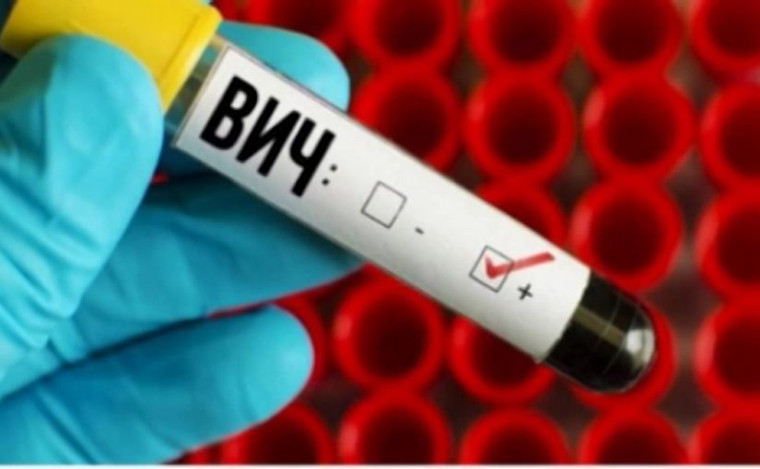 Профилактика ВИЧ-инфекции.